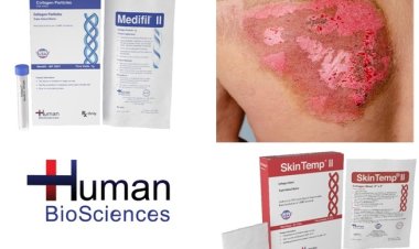 First aid response to burns can improve outcomes